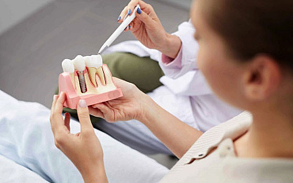 dental implants failure Dental Implant Failure Antalya, Turkey