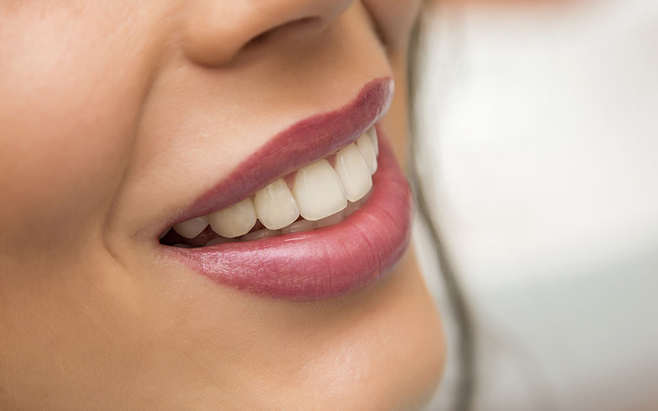 Hollywood Smile Antalya Turkey